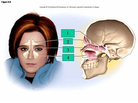 Waspadai Pilek Lama, Sinusitis&nbsp;mengintai
